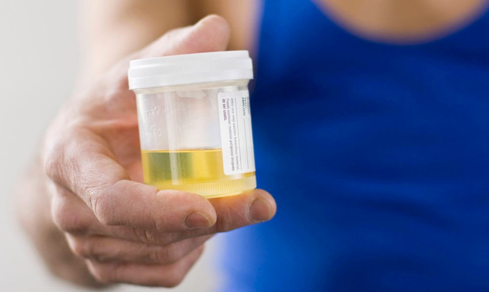 Where to Buy Synthetic Urine Central Park Townsite Belgrade MT Data